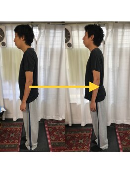 新橋整体グッドラックカイロプラクティック(Good Luck)/重心が前にかかってアンバランス