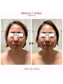 サロン ド ミミ(salon de mimi)/小顔BeforeAfter