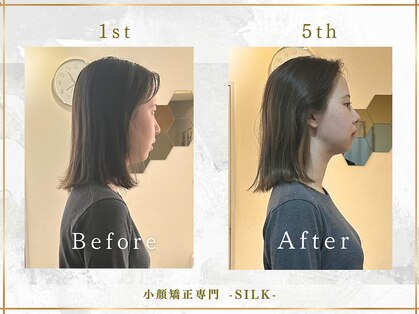 シルク(SILK)の写真