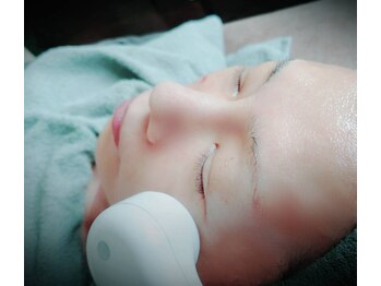 ハッピーコアスマイル(Happy Core Smile)/ポレーション導入