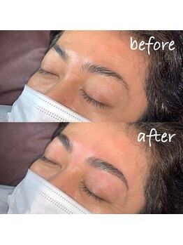 アンベリール(embellir)/ハリウッドブロウリフト(HBL)