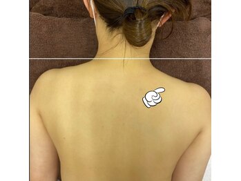 トータルエステサロン エステアンドメイク 錦糸町/最速痩せならプロにお任せ下さい