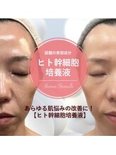 エレニア(Elenear)/大人気★フェムフェイシャル