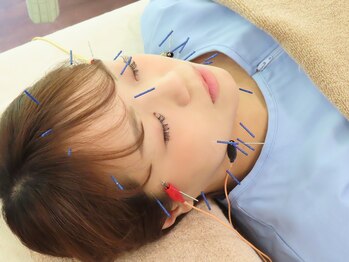 たんぽぽ鍼灸整体院/美容針、鍼灸施術、美容整体♪
