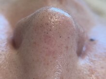 リセットプラス(Reset+)/