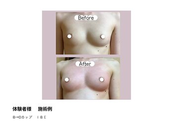 アップオー 天神大名店(up O)/