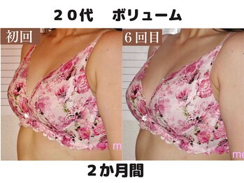 バストサロン メルベイユ(Merveile)/ボリューム・立体感UP