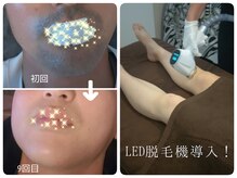 エムブルーム(m-bloom)