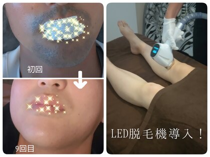 エムブルーム(m-bloom)の写真