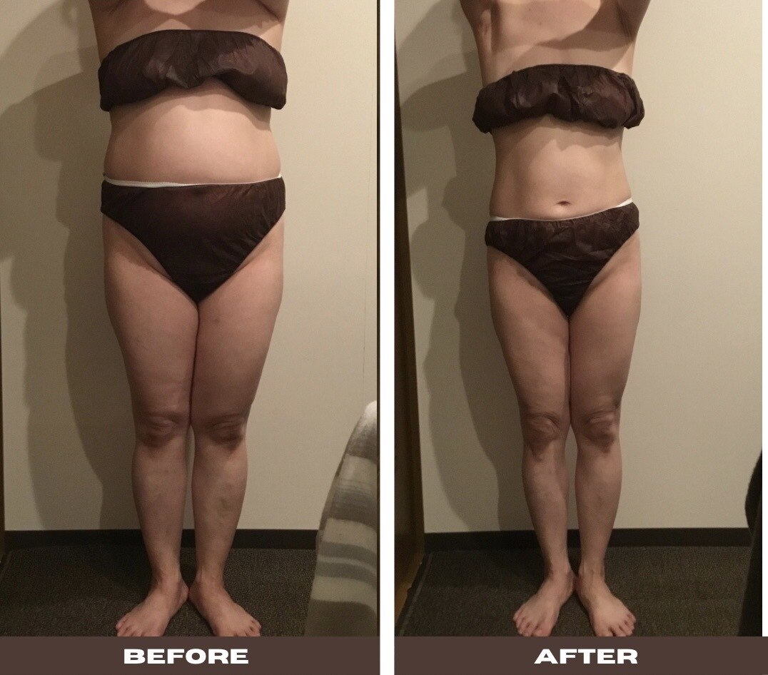 シェリーク 東京店｜ホットペッパービューティー