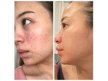 シファ(SHIFA)の雰囲気（私自身も悩んだ経験から、綺麗になる最短ルートをご提案します）