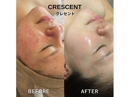 クレセント(CRESCENT)の写真