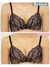 ラビス(RAVIS)/30代☆産後のバストアップ