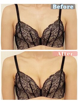 ラビス(RAVIS)/30代☆産後のバストアップ