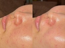 ルーナジェーナ(Luna llena)/池袋　エステ　ルーナジェーナ