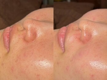 ルーナジェーナ(Luna llena)/池袋 エステ ルーナジェーナ