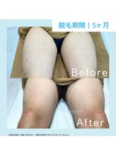 メンズクリア 武蔵小杉店/【メンズクリア】お客様の施術例