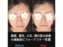 美容矯正サロン レレポノ(LELEPONO)/