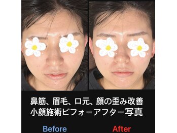 美容矯正サロン レレポノ(LELEPONO)/