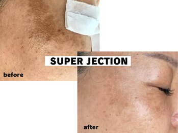 ラウ 広島呉店(laut)/【スーパージェクション】