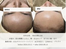 エメ(aimer)/SkinCare《肌管理・エイジング》