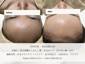 エメ(aimer)/SkinCare《肌管理・エイジング》