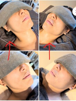 メグリ(めぐRe.)/黄金比トリートメント前と後