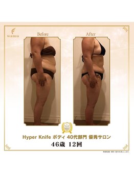 タノソイネ(tanosoine)/【46歳12回/ハイパーナイフ】