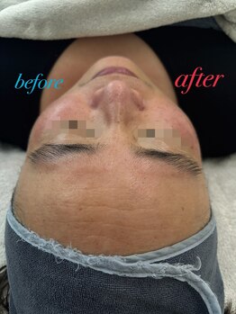 ファーファラ(Farfalla)/EMS×AIRBARI