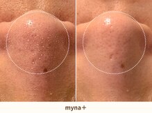 マイナプラ 表参道(myna+)/