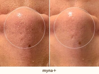 マイナプラ 表参道(myna+)/