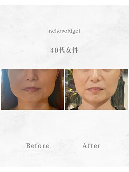 ねこのひげ/お客さんの変化