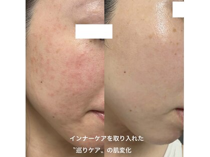 ルフローラ(Ruflora)の写真