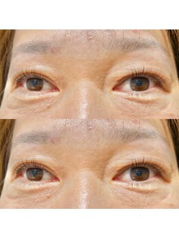 モードケイズ マノン(MODE K's MANON)/ラッシュリフト、まつげパーマ