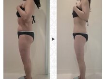 ニュイブラーシュ(nuit blanche)/ハイパーナイフ夢のサイズダウン