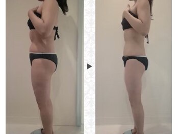 ニュイブラーシュ(nuit blanche)/ハイパーナイフ夢のサイズダウン