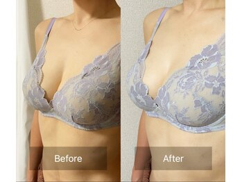 ハートランド(HEARTLAND)/プチ・クレオパトラ　1回