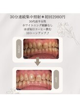 プラスビーセルフ(+b self)/ビフォーアフターのお写真です！