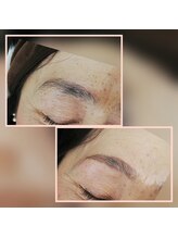 エクラ(eclat)/HBL　ハりウッドブロウリフト