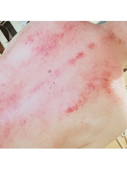 プルトア/於血とは？