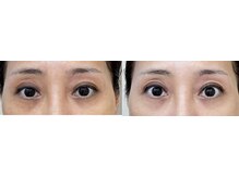 エレガンテ(ELEGANTE)/最新プラズマシャワー　