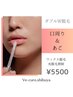【口周り&あご】スキンケアワックス＋美肌高速脱毛器のダブル脱毛5500円