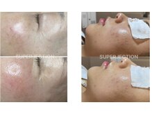 ラウ 広島呉店(laut)/【スーパージェクション】