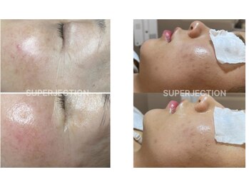 ラウ 広島呉店(laut)/【スーパージェクション】