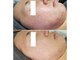 アモリアージュ(Amolliage)の写真