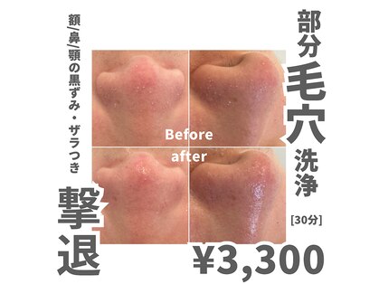 メンズエムボーテ 太田店(Men's M BEAUTE33)の写真