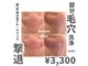 メンズエムボーテ 太田店(Men's M BEAUTE33)の写真