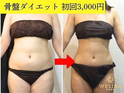 美容整体ウェリナ あま甚目寺院の写真