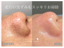 ティセラ(TISERA.)の雰囲気（【ニキビケア・毛穴ケア】肌質改善カスタム施術でお悩み根本改善）