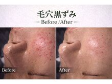 ワイズデュー(Y's Dew)